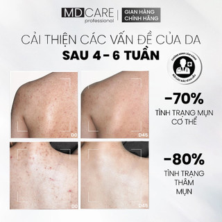 (TEM CÔNG TY) Xịt Tẩy Tế Bào Chết Toàn Thân AHAs & BHA MD CARE Exfoliating Body Spray 100ml