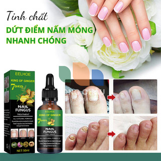 Serum Huyết Thanh Diệt Nấm Móng EELHOE Nail Fungus Thảo Dược Tự Nhiên Xử Lý Nấm Móng, Khoẻ Móng, Thối Bọng Móng 30ml