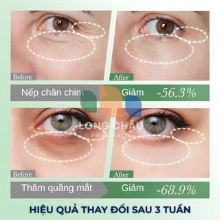 Kem Tan Quầng Thâm Bọng Mắt Open Eyes Mỹ Xoá Tan Quầng Thâm Bọng Mắt Vết Chân Chim