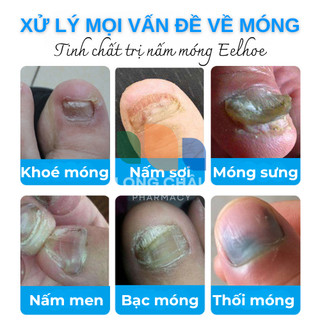 Serum Nấm Móng EELHOE MỸ Đánh Bay Nấm Móng Thối Móng Bọng Móng Khoé Móng Dưỡng Móng Chắc Khoẻ