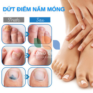 Serum Nấm Móng EELHOE MỸ Đánh Bay Nấm Móng Thối Móng Bọng Móng Khoé Móng Dưỡng Móng Chắc Khoẻ