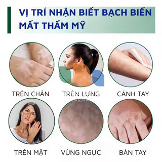 Cao Bôi Bạch Biến Lang Ben SAKIMI Chiết Xuất Thảo Mộc Hết Ngứa Bạch Biên Lang Ben Đốm Trắng Khôi Phục Kết Cấu Da