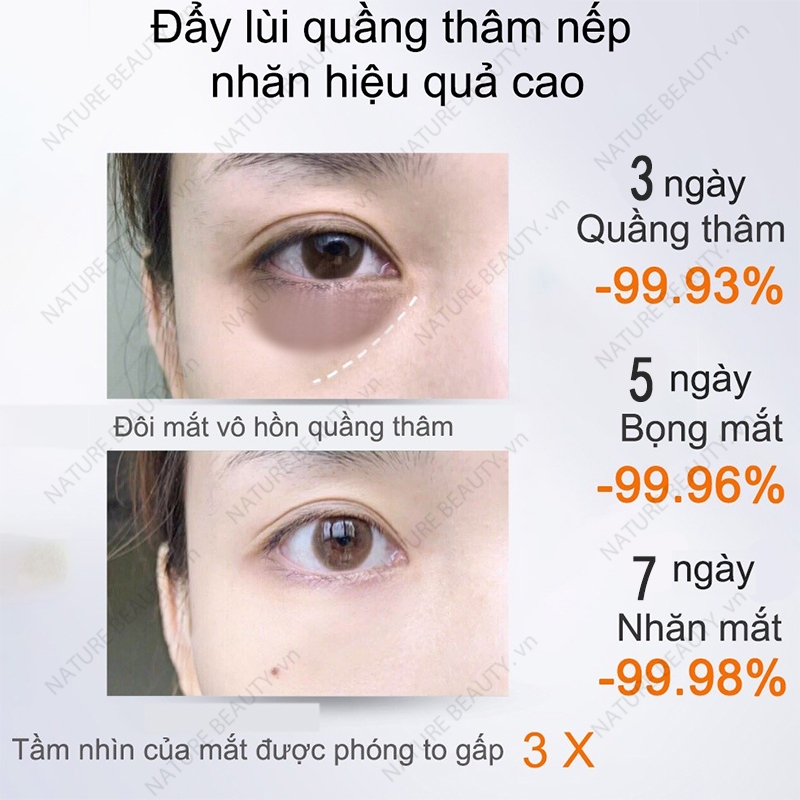 Sử dụng Tuýp Kem Mắt Giảm Thâm Quầng trong đời sống
