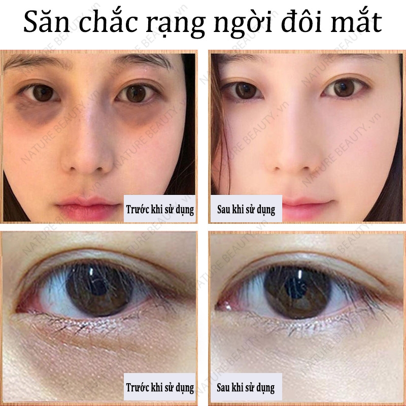 Chất lượng Kem Mắt Giảm Thâm Quầng Tiêu Chuẩn