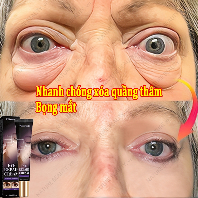 Kem Mắt Giảm Thâm Quầng - Hình ảnh thực tế