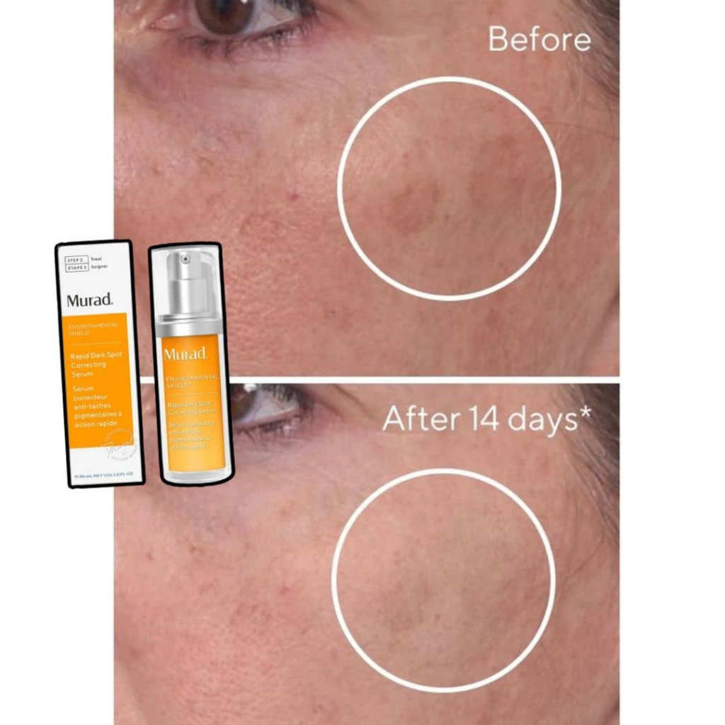 Tinh Chất Hạn Chế Thâm, Làm Sáng, Đốm Nâu Murad Rapid Dark Spot Correcting Serum