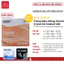 Eye Plus Chiết Suất 1.60/1.67 Chống Ánh Sáng Xanh Và UV Độ Bền Cao