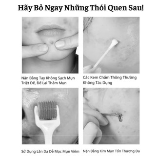 Chính Hãng Kem Sạch Mụn Senana Đánh Bay Các Loại Mụn Sưng Mụn Cơm Mụn Ẩn Mụn Viêm Trên Da 20G