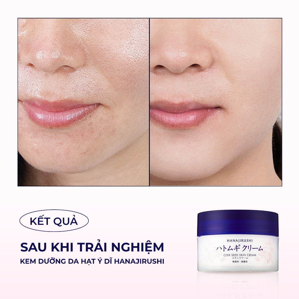 Kem Dưỡng Da căng bóng, dưỡng trắng da HANAJIRUSHI COIX SEED SKIN CREAM 100g