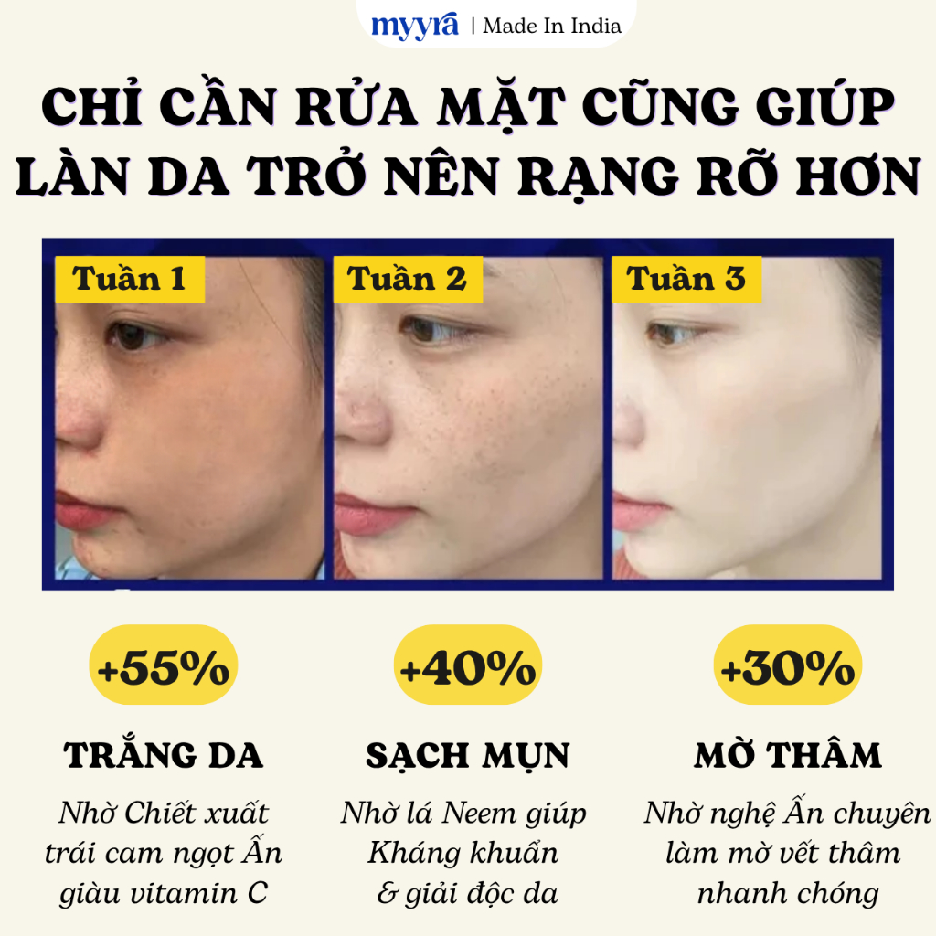 SỬA RỬA MẶT TRẮNG DA TỨC THÌ CHO DA DẦU MỤN | 8 TIẾNG KIỀM DẦU, TRẮNG MỊN DA, XOÁ THÂM NGỪA MỤN ABB2