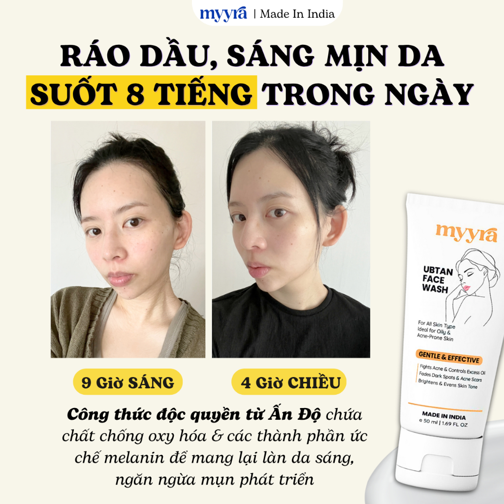 SỬA RỬA MẶT TRẮNG DA TỨC THÌ CHO DA DẦU MỤN | 8 TIẾNG KIỀM DẦU, TRẮNG MỊN DA, XOÁ THÂM NGỪA MỤN ABB2