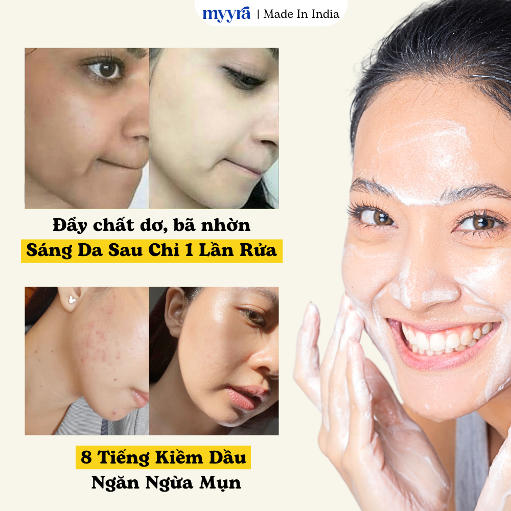 SỬA RỬA MẶT TRẮNG DA TỨC THÌ CHO DA DẦU MỤN | 8 TIẾNG KIỀM DẦU, TRẮNG MỊN DA, XOÁ THÂM NGỪA MỤN ABB2