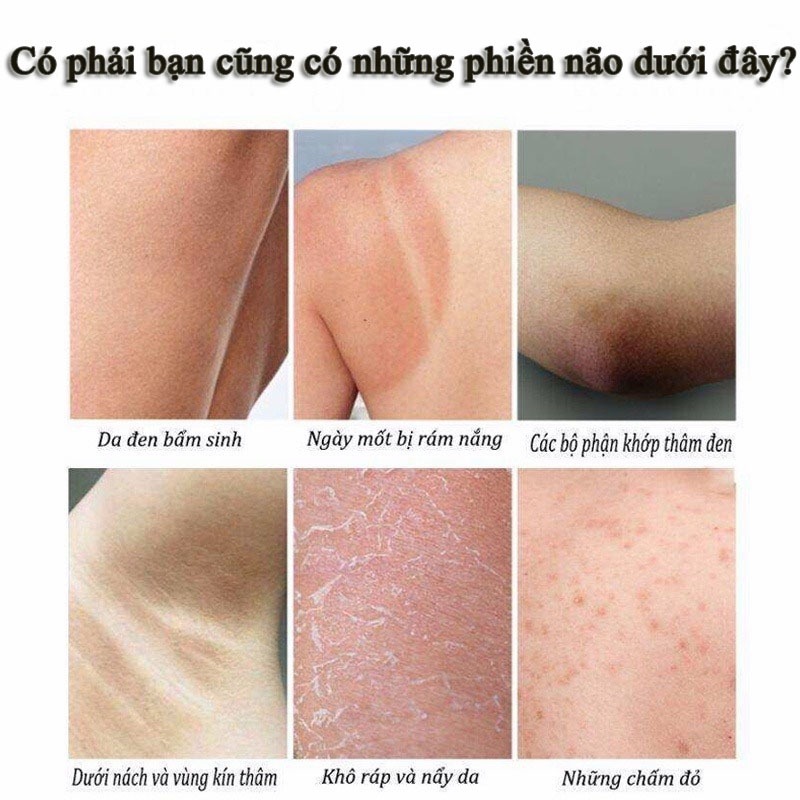 Sử dụng Chai Sữa Dưỡng Thể Vaseline 500ml trong đời sống
