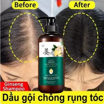 dầu gội gừng dầu gội giảm rụng tóc Dầudầu gội gừng dầu gội giảm rụng tóc Dầu gội kích thích mọc tóc Mọc Tóc Nh