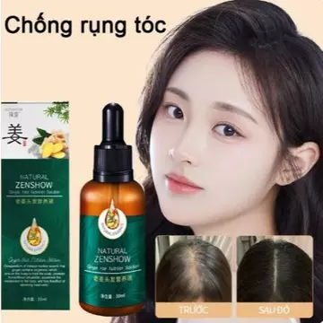 dầu gội giảm rụng tóc dầu gội gừng Dầu gội kích thích mọc tóc Dầu Gội Mọc Tóc Nhanh kiểm soát dầu loại bỏ gàu