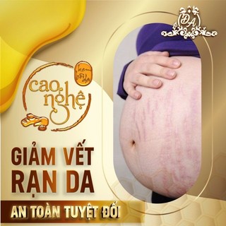 Cao nghệ phục hồi chuyên sâu Collagen X3 - Mỹ phẩm Đông Anh