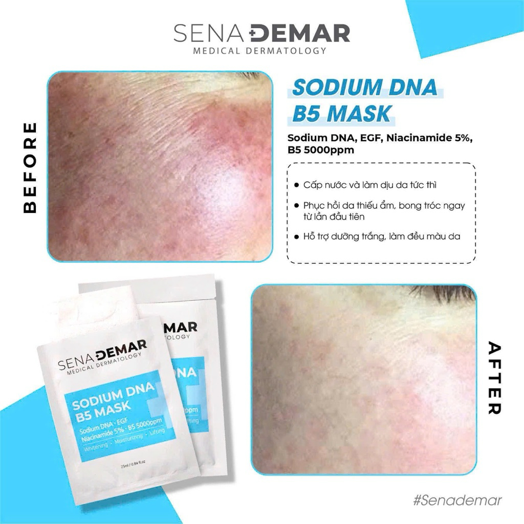 Combo 30-50 miếng Mặt nạ Sena demar sodium DNA B5 mask, 25ml - hạn 2028 HQ mặt nạ senademar  IS351