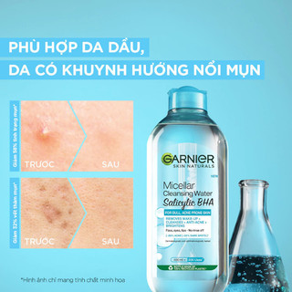 Nước Tẩy Trang Garnier Salicylic BHA Micellar Cleansing Water Cho Da Dầu Mụn 400ml Duduhouse