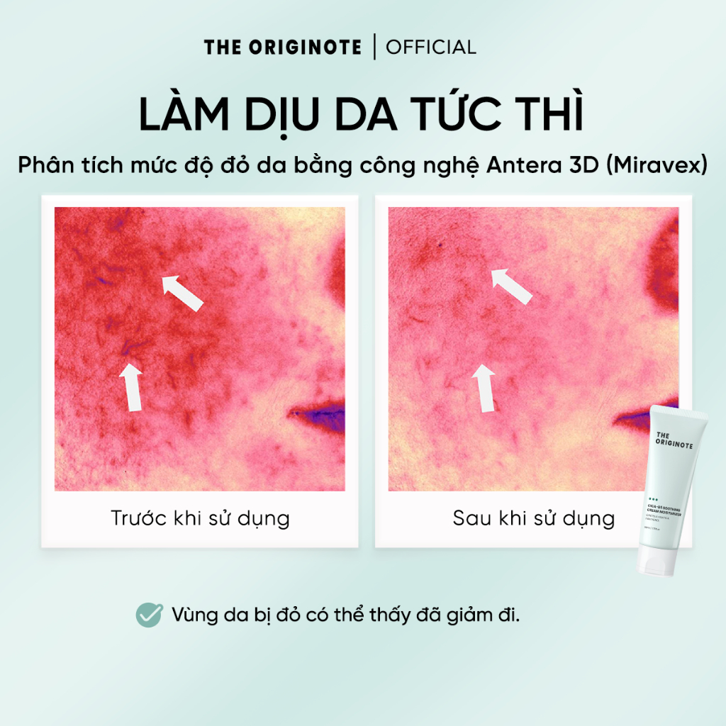 Kem dưỡng ẩm CICA B5 làm dịu da The Originote dưỡng ẩm phục hồi giảm mụn cải thiện hàng rào bảo vệ da Moisturizer
