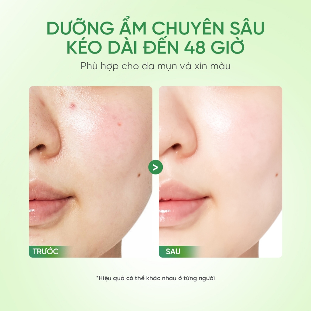 Kem Dưỡng Làm Dịu Da Cica-B5 The Originote phục hồi dưỡng ẩm giảm mụn cải thiện hàng rào bảo vệ da Soothing Moisturizer
