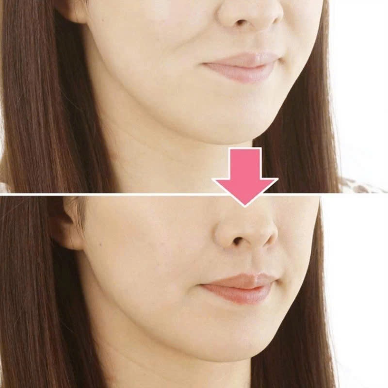 DỤNG CỤ NGĂN NGỪA VẾT NHĂN LÀM GỌN CẰM - Bóng Tạ Tập Nâng Cơ Rãnh Cười,Dụng Cụ Tập Thể Dục Miệng Nâng Cơ Hàm