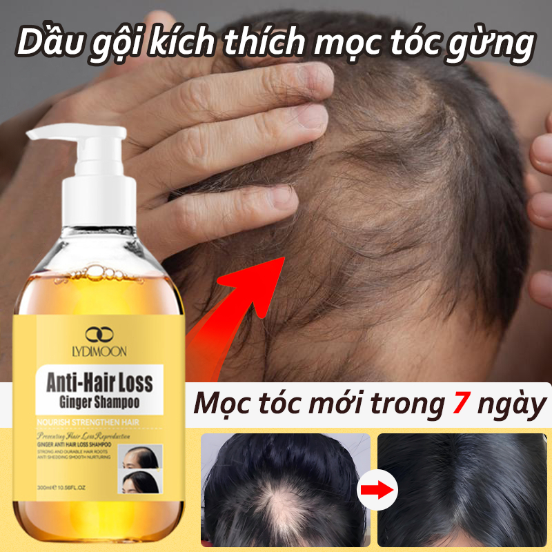 Dầu gội gừng Dầu gội mọc tóc Dầu gội chống rụng tóc Tóc mọc nhanh Giảm rụng tóc Chăm sóc tóc 300ml