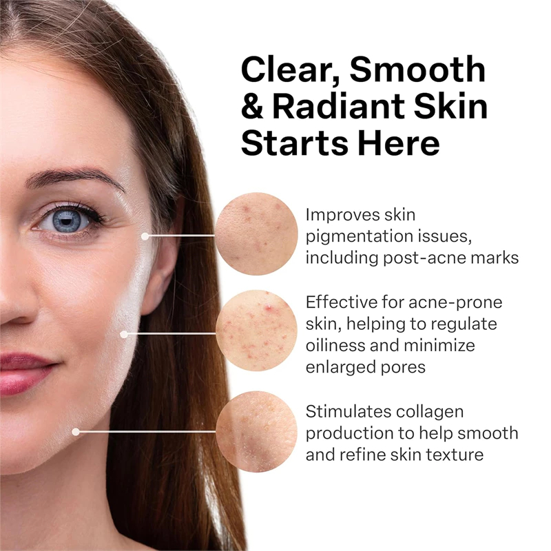 Kem A313 Retinol 50g Pháp Giúp Chống Lão Hóa, Giảm Mụn, Giảm Thâm 50g
