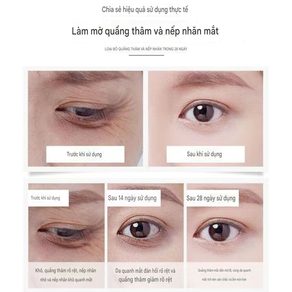 Son Dưỡng Quầng Thâm Mắt ENADE (10ml) - Hỗ Trợ Giảm Quầng Thâm Mắt,Giảm Nếp Nhăn Chiết Xuất Nghệ Trắng