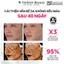Serum Sáng Da Đa Tầng MD CARE Brightenyl 30ml