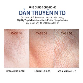 Mặt Nạ Thạch Nâng Cơ Dưỡng Ẩm Săn Chắc Căng Mịn Da Arocell Botulcare Mask 42g | Hộp 4 Miếng