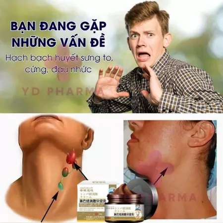 Kem Tan Sạch U Hạch Bạch Huyết Lymphoma Nhật Bản Shixendo 30g Tiêu U Giảm Đau Sưng Hạch Hiệu Qủa