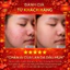 COMBO 5 CHAI) Serum giảm mụn thâm - Skin 7 Days Plus - 10ml
