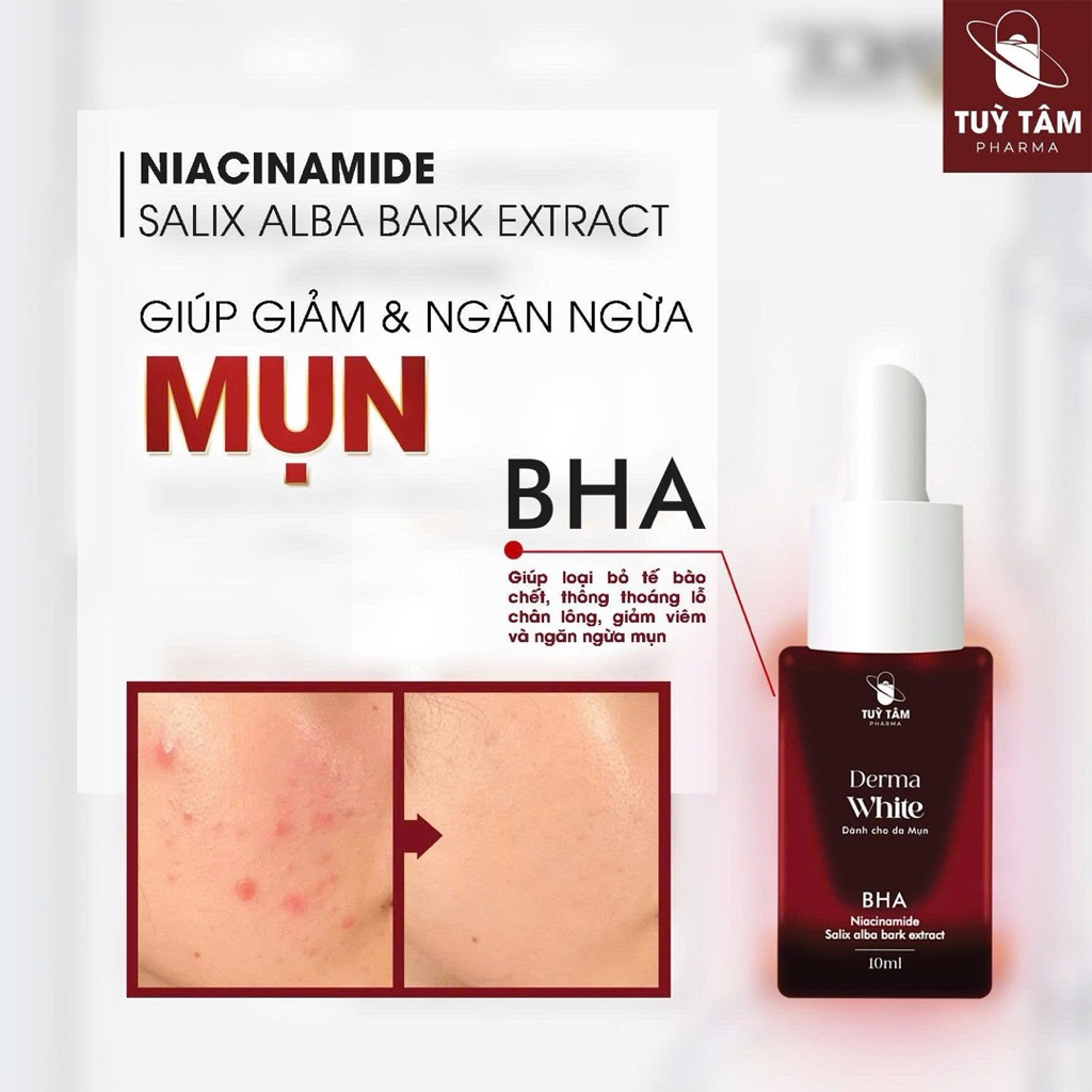 Kem mụn Wonder Serum Mụn - Hỗ trợ phục hồi, giảm thâm, làm dịu làn da tại vị trí Mụn 5ml - Tùy Tâm Pharma