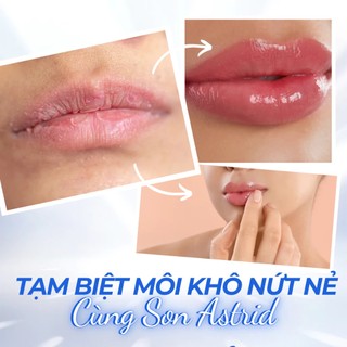 [Y304] [HỎA TỐC] Son Dưỡng Môi Mỡ Hươu ASTRID Multivitamin - Tái tạo, Mềm Môi, Dưỡng Ẩm, Tẩy Da Chết