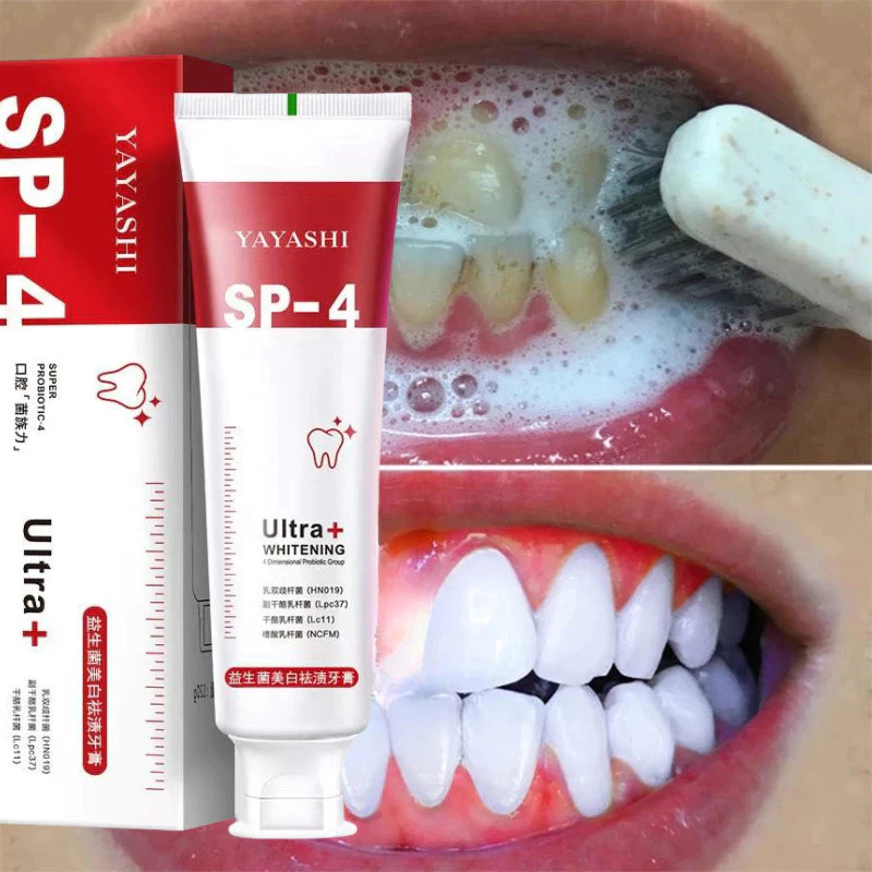 [CHÍNH HÃNG] Kem đánh răng Sp-4 làm trắng răng, cải thiện vết ố vàng và ngừa sâu răng, miệng thơm tho suốt cả ngày
