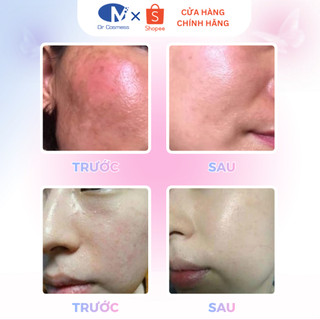 Kem Dưỡng Hồng Nhũ Hoa, Giảm Thâm Hiệu Quả, Làm Hồng Tự Nhiên Dr Cosmess Rosyluster Cream 15gr