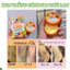 Kem Trắng Nách S88 Total White Underarm Cream Thái Lan – Khử Thâm Nách, Giảm Mùi Hôi, Dưỡng Trắng Da Vùng Nách Nội Địa