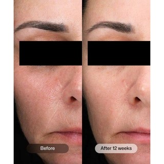 Tinh Chất Dưỡng Trẻ Hóa Da Và Kích Hoạt Năng Lượng Tế Bào Revision D-E-J Boosting Serum 15ml