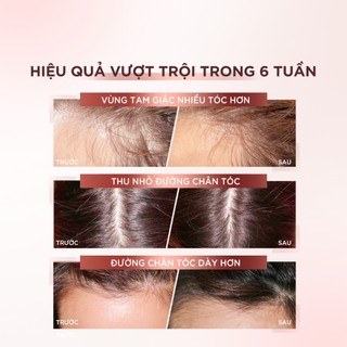 Bộ dầu gội xả & xịt serum ngăn ngừa & giảm gãy rụng tóc, tóc chắc khỏe hơn L’oreal Paris Full Resist 440mlx2, 90ml