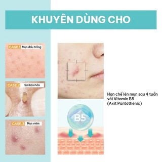 Kem dưỡng làm dịu da Numbuzin No.1 Pantothenic B5 Active Soothing Cream 80ml
