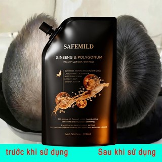 Phù hợp cho người rụng tóc nhiều, Dầu gội thảo mộc cô đặc SAFEMILD 300ml, hỗ trợ giảm rụng tóc