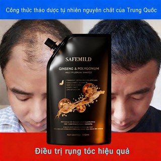 Phù hợp cho người rụng tóc nhiều, Dầu gội thảo mộc cô đặc SAFEMILD 300ml, hỗ trợ giảm rụng tóc