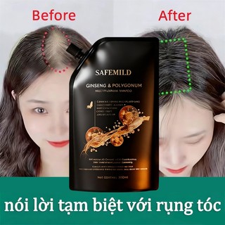 🔥Dầu gội thảo mộc SAFEMILD 300ml, hỗ trợ che phủ tóc bạc, giảm rụng tóc và nuôi dưỡng da đầu