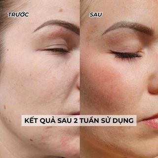 Tinh Chất Tái Tạo Cấu Trúc, Làm Săn Chắc Và Căng Bóng Da Toskani Lipo-Proteoglycans Ampoule