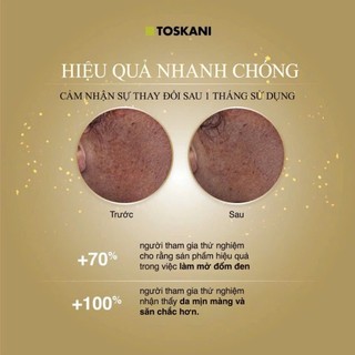 Tinh Chất Làm Sáng Da, Mờ Thâm Nám Sạm Toskani Radiance Ultimate Mesoserum Tranex