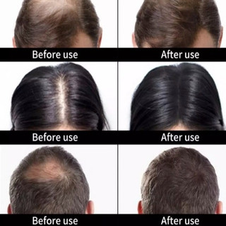 Bột Phủ Tóc Toppik 27.5g | Che Hói, Che Tóc Thưa | Làm Dày Tóc Tức Thì | Keratin Tự Nhiên Nam Nữ