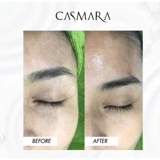 Kem Dưỡng Giảm Quầng Thâm Và Bọng Mắt Casmara Eye Contour Anti-Puffiness & Dark Circles 15ml