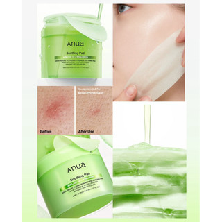 Toner pad ANUA (Heartleaf/Glow/Brigtening/Soothing)