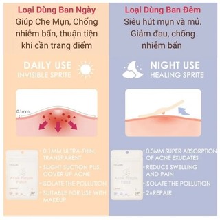 Miếng Dán Mụn FOCALLURE Nhiều Kích Cỡ Sử Dụng Cho Cả Ngày Và Đêm 24 miếng - Bebeau