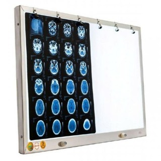 ĐÈN ĐỌC PHIM XQ THÀNH NHÂN TNE. Đèn đọc 2 phim ánh sáng Led  X Quang, CT, MRI.